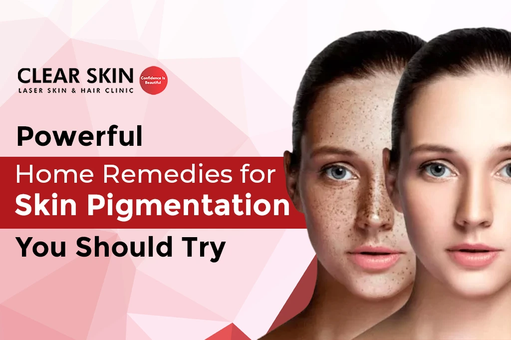 🌿7 Simple and Best Home Remedies for Dark Spots on Face🌿 Know about 7  simple and best home remedies for dark spots on face. These easy tips tone  skin, enhance glow and
