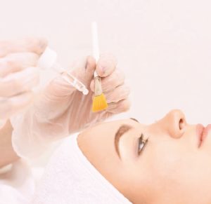 Does a Facial Help with Acne Scars?: Benefits Of Facial Treatment