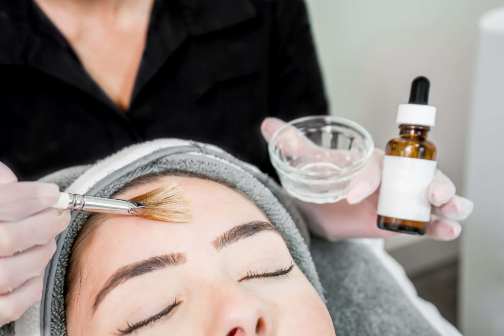 application of chemical peel on the forehead