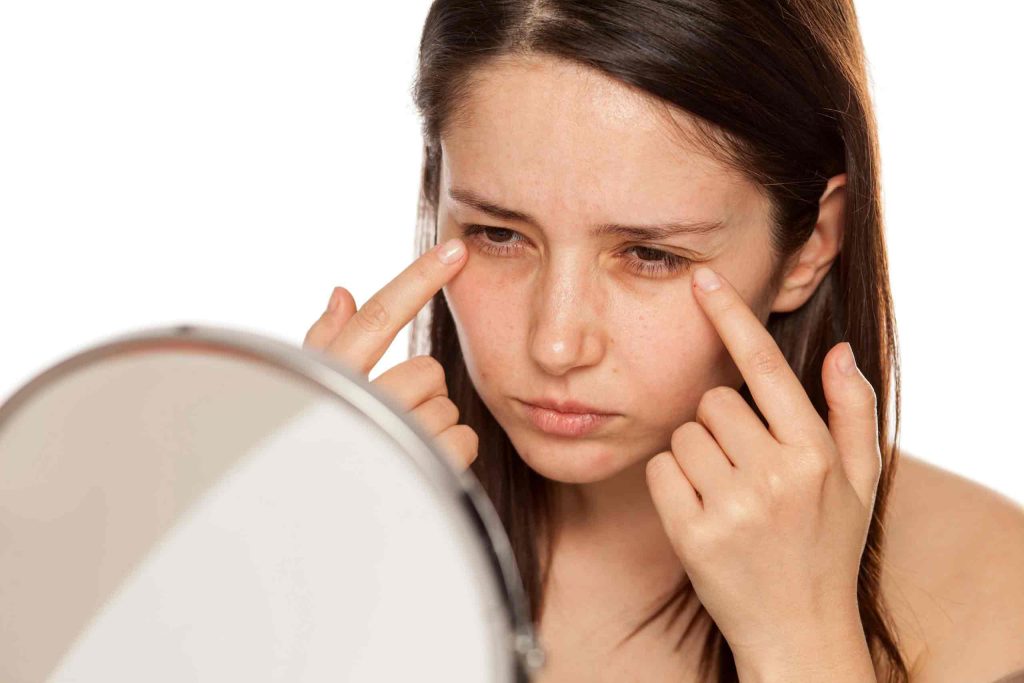 Under Eye Wrinkles: Age Factor, Causes, Treatments & Prevention