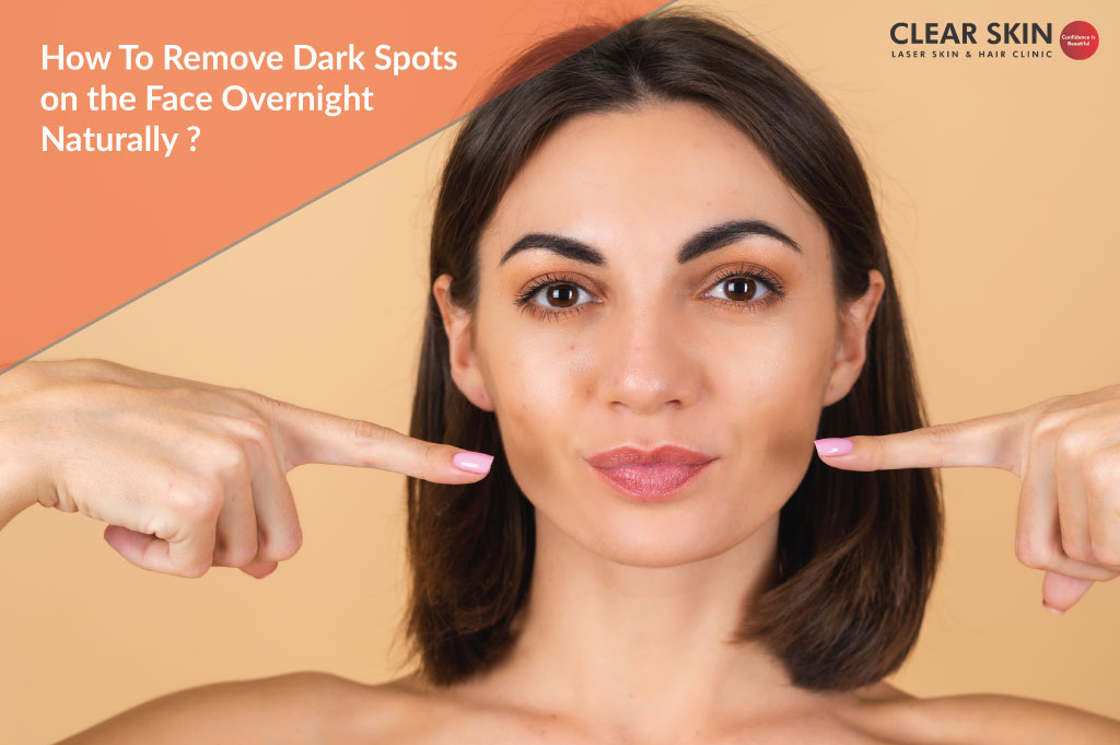 to Remove Dark Spots on the Face Overnight Naturally?