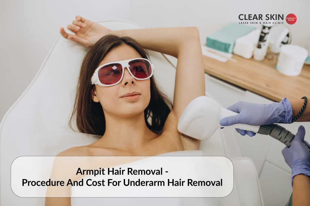 Diode Laser Hair Removal  Benefits and Treatment Cost  Clear Skin Pune