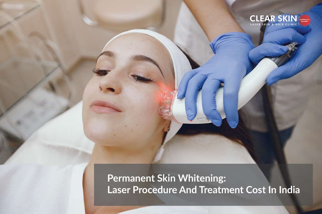 Permanent Skin Whitening Laser Procedure And Treatment Cost In India 