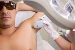 Armpit Hair Removal – Permanent or Long-Term Solutions