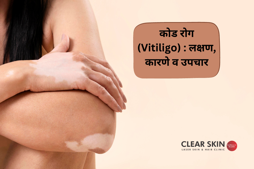 काय आहे सेल्युलाइट? महिलांमध्येच ही समस्या का होते? - Marathi News | What  is cellulite? Why do women have this problem? | Latest health News at  Lokmat.com