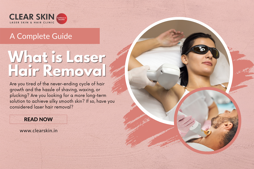 Top 5 Benefits of Laser Hair Reduction in Men and Women  Desmoderm