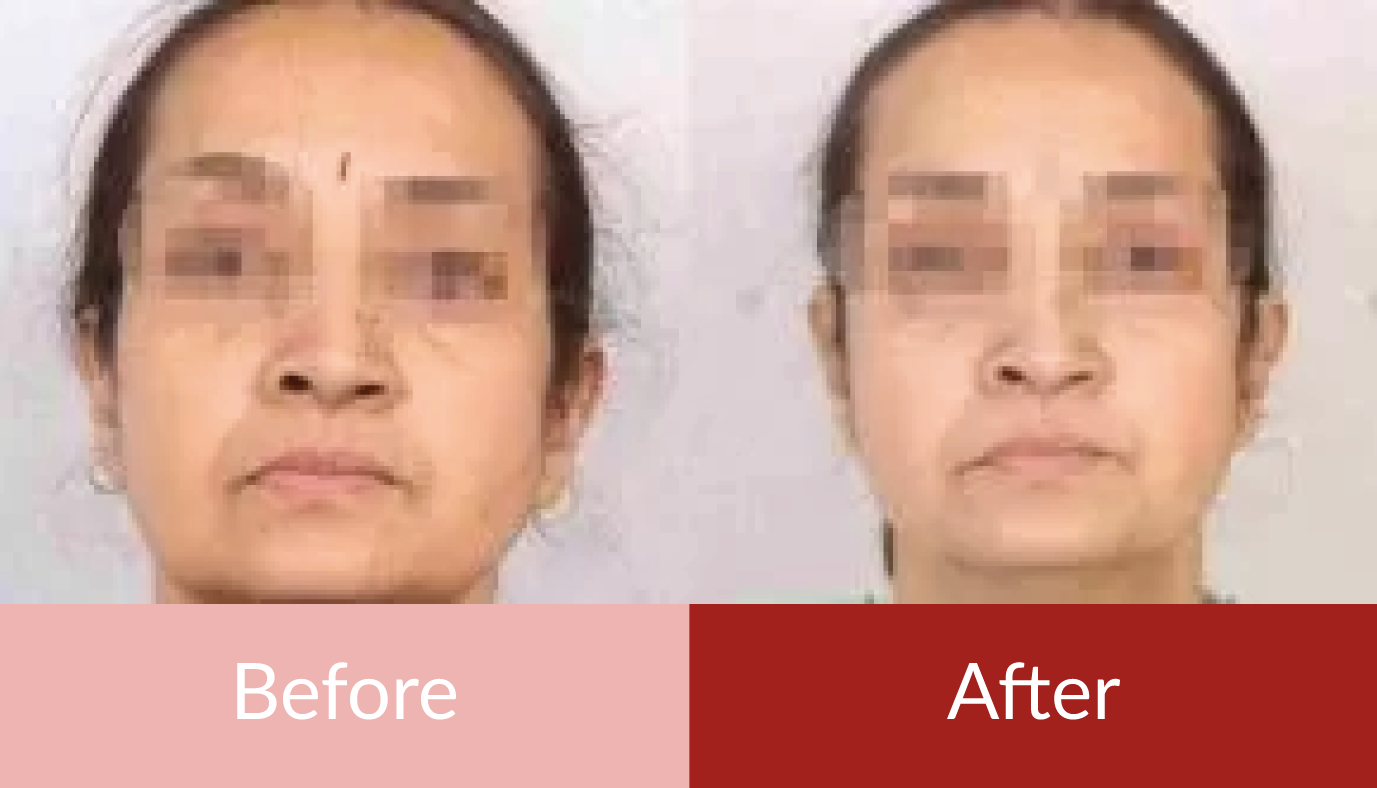 Before & After Anti-Aging Skincare Results