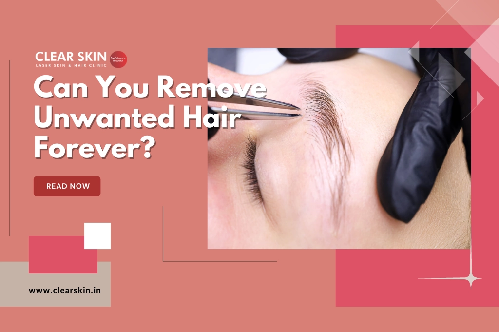 Can You Remove Unwanted Hair Forever? 