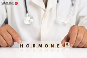 Causes of Melasma in Men: Hormonal Changes