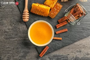 Cinnamon Based Home Remedies For Acne
