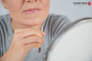 How Does Thyroid Cause Unwanted Hair Growth?