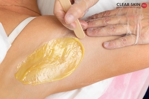 How to Stop Unwanted Hair Growth in Women?