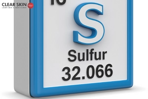 Sulfur for Melasma