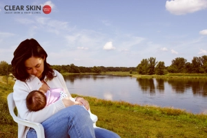 What Causes Melasma During Breastfeeding?