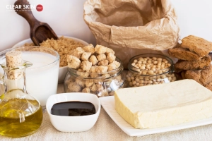 Which foods worsen melasma?