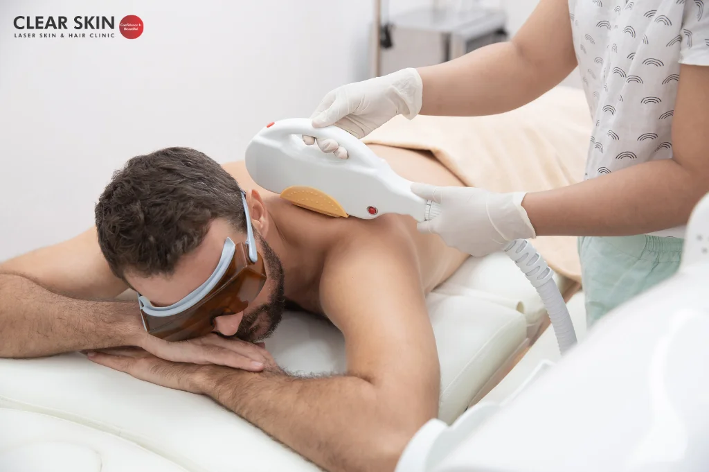  Why laser hair removal is expensive?