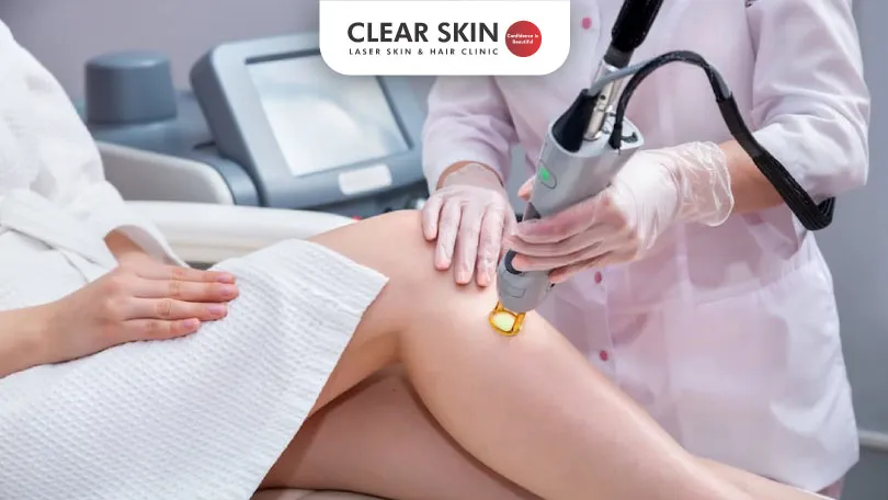 How Painful is Laser Hair Removal Really clear skin pune