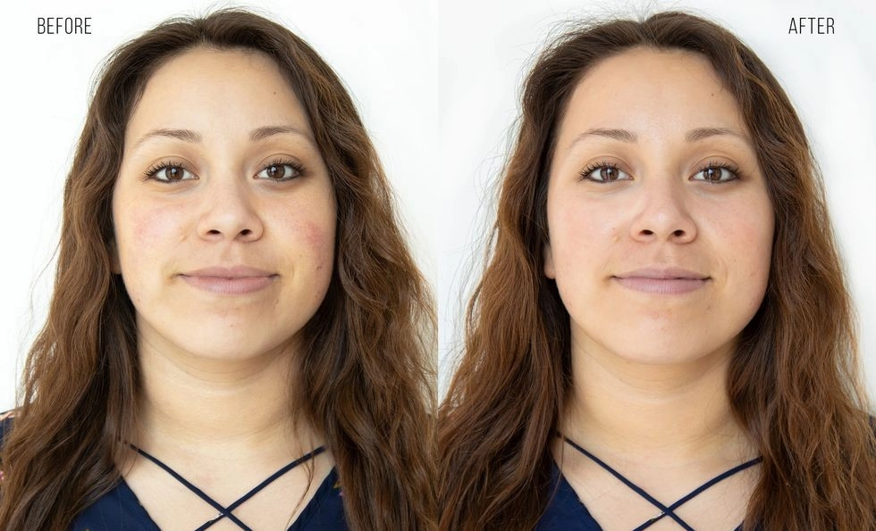 Before and after images of Skin Glow with Tightening facial.