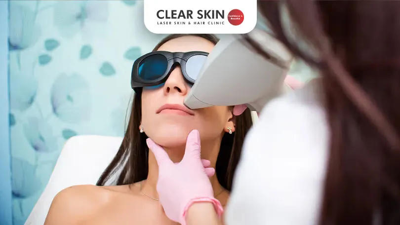 Laser Hair Removal and Skin Rejuvenation Must Know Facts clear skin pune