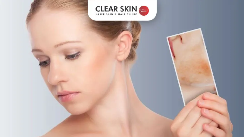 Encountering the distinctive Skin Pigmentation problems clear skin pune