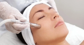 Microdermabrasion Treatment