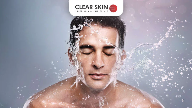 Skin Darkening Due to Water Change Clear Skin Pune