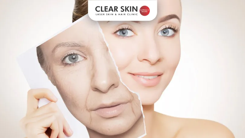 Skin Treatments for Anti-Aging