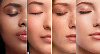 Skin Types