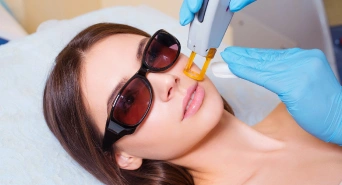 Vascular Laser Therapy