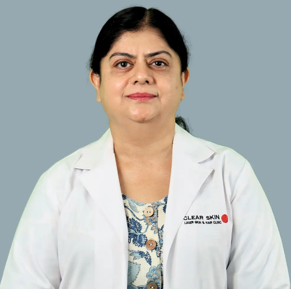 Skin Doctor in Prabhat Road Clear Skin, Pune