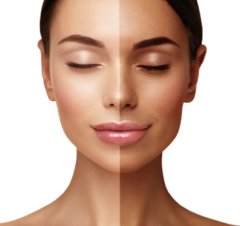 pigmentation treatment pune