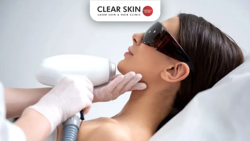 5 Factors Affecting the Cost of Laser Hair Removal Clear Skin Pune