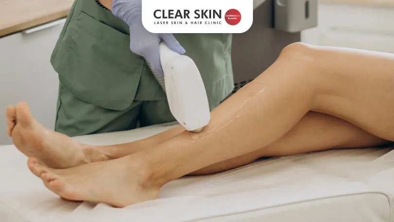 Are There Any Side Effects of Laser Hair Removal?