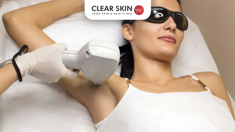 Armpit Hair Removal Procedure and Cost Clear Skin Pune