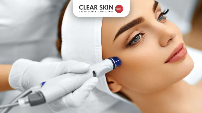 Can Microdermabrasion Work for Skin Polishing?