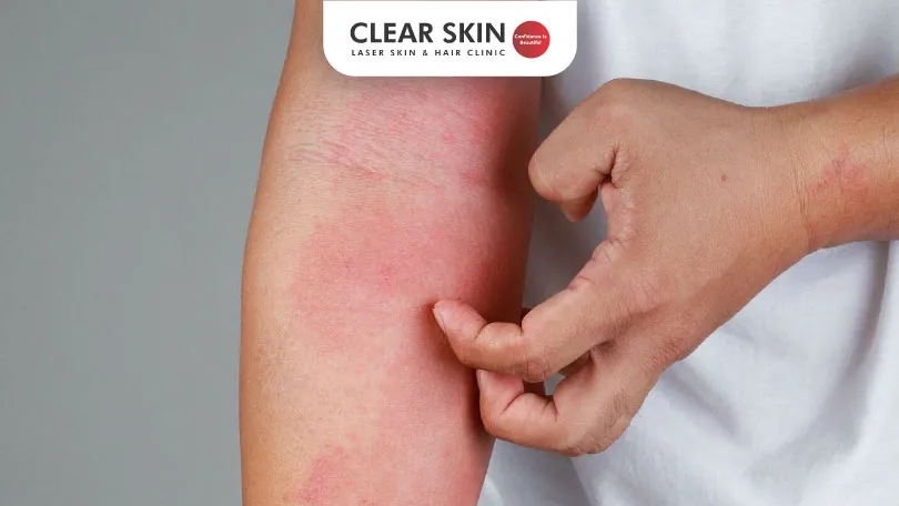 Causes of Itchy Skin and Effective Treatment Methods