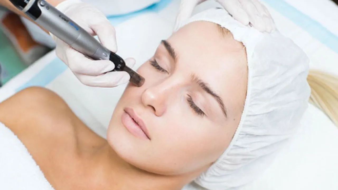 Dermapen Microneedling Treatment Procedure