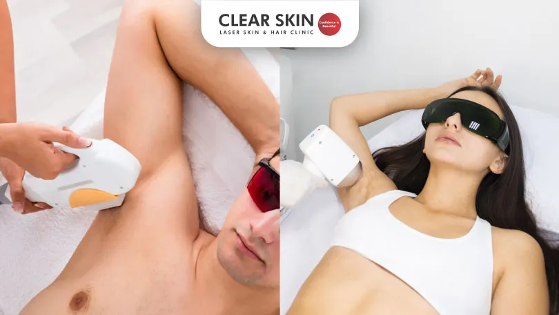 Do's-and-Don'ts-of-Laser-Hair-Removal-Before-and-After-clear-skin-pune