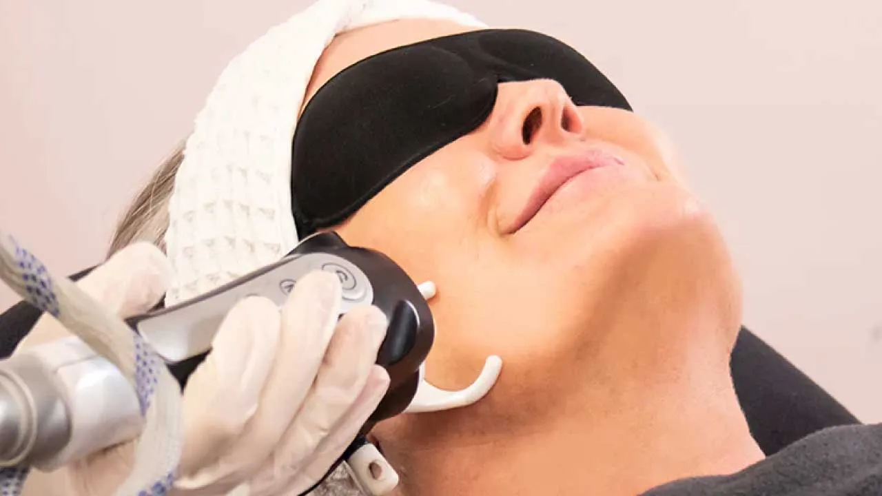 Fractional Laser Skin Resurfacing Treatment