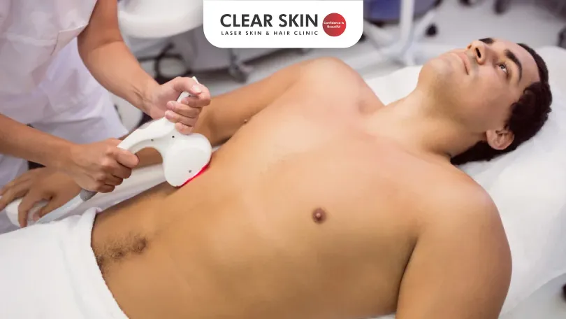 Full Body Laser Hair Removal: A Complete Step-by-Step Guide for Smooth Skin