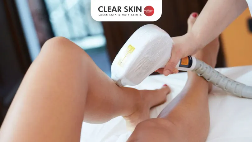 How Many Laser Treatments for Permanent Hair Removal are Effective Clear Skin Pune