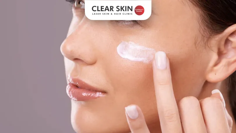 Choosing the Right Melasma Cream for Sensitive Skin: Tips and Recommendations