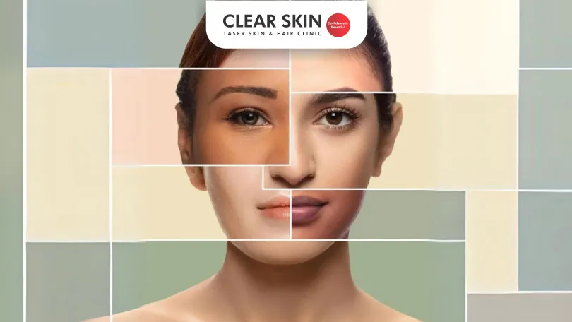 How to know your Skin Type?