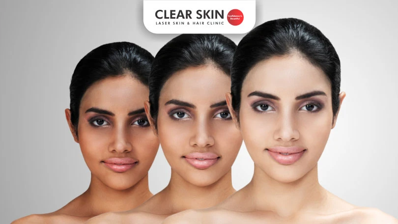 How to lighten skin tone