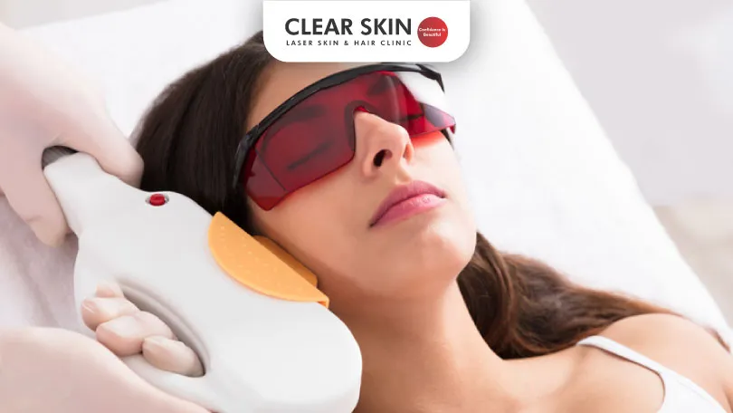 Intense Pulsed Light (Ipl) Skin Rejuvenation Treatment