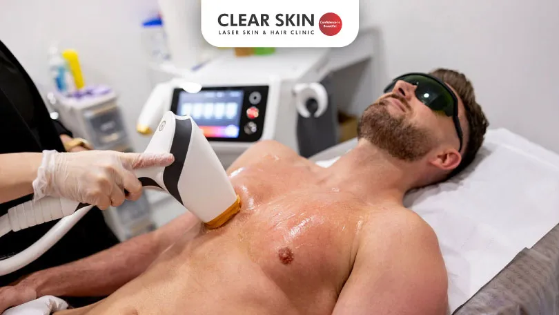 Is Laser Hair Removal Safe A Comprehensive Guide Clear Skin Pune