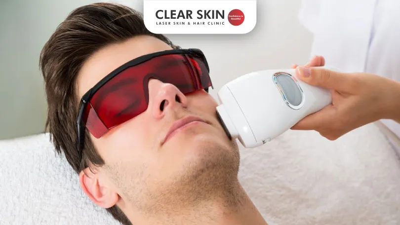 Is-laser-hair-removal-safe-for-Your-face-Clear-Skin-Clear-Skin-Pune