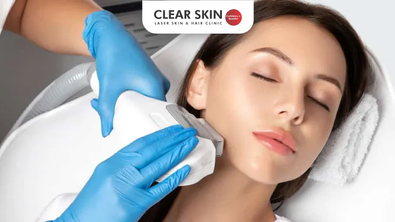 Laser Hair Removal Process Clear Skin Pune