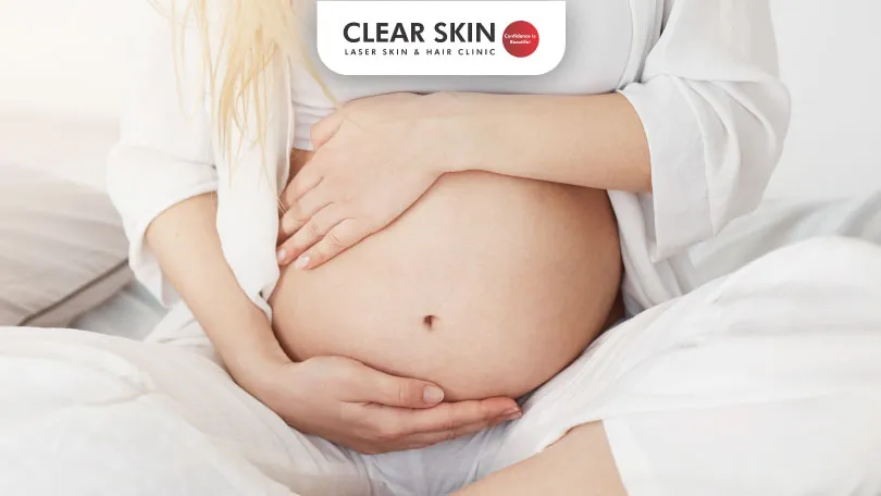 Laser Hair Removal and Pregnancy – What Do You Need to Know