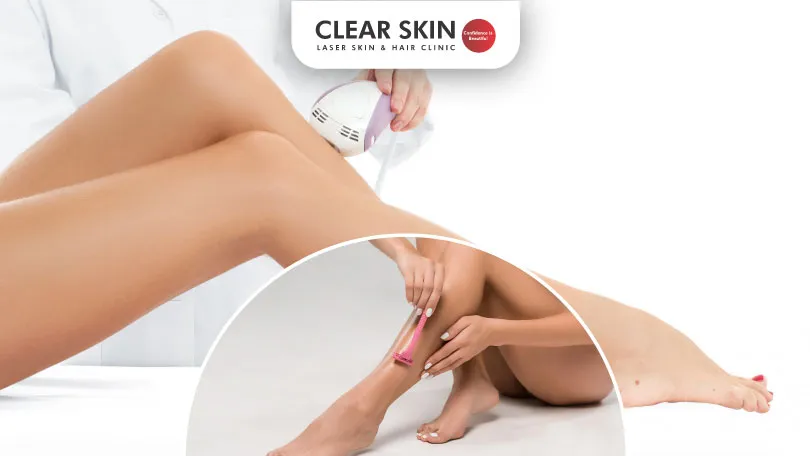 Risks and Benefits of Shaving Before Laser Hair Removal